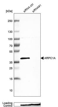 抗ARPC1A抗体 ウサギ宿主抗体 Prestige Antibodies&#174; Powered by Atlas Antibodies, affinity isolated antibody, buffered aqueous glycerol solution