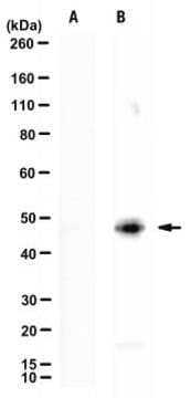 Anti-Nebulin exon 144 Antibody, clone NEB-9H1