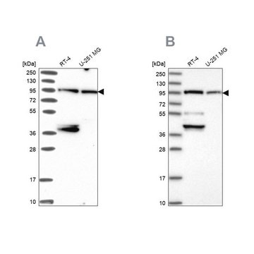 Anti-UBE3A antibody produced in rabbit Prestige Antibodies&#174; Powered by Atlas Antibodies, affinity isolated antibody, buffered aqueous glycerol solution