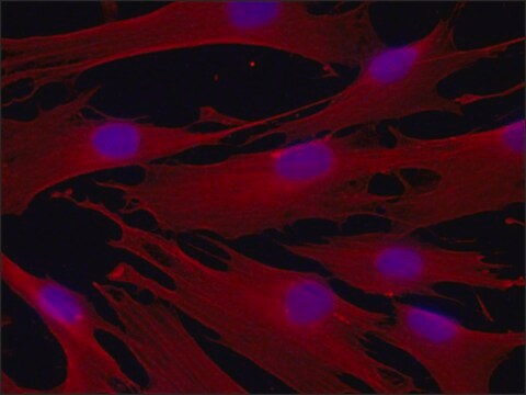 Anti-&#946;-Tubulin IV antibody, Mouse monoclonal clone ONS.1A6, purified from hybridoma cell culture