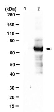 Anti-Adenovirus 5 DBP Antibody, clone B6-8