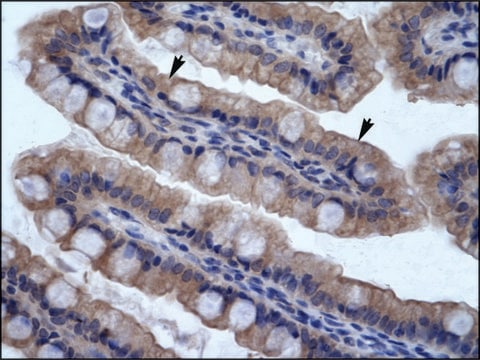 Anti-SMPDL3B antibody produced in rabbit affinity isolated antibody