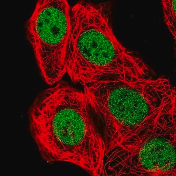 Anti-BCL7B antibody produced in rabbit Prestige Antibodies&#174; Powered by Atlas Antibodies, affinity isolated antibody