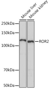 Anti-ROR2 Antibody, clone 0B7X8, Rabbit Monoclonal