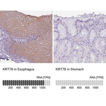 Anti-KRT78 antibody produced in rabbit Prestige Antibodies&#174; Powered by Atlas Antibodies, affinity isolated antibody, buffered aqueous glycerol solution