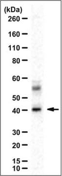 Anti-Sharpin Antibody from rabbit, purified by affinity chromatography