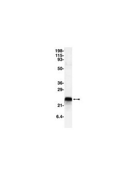 Anti-CPI-17 Antibody Upstate&#174;, from rabbit