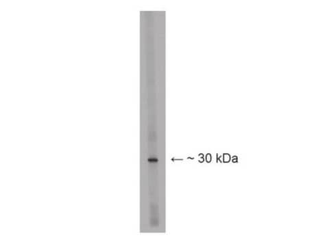 Anti-Lbx1 Antibody Chemicon&#174;, from rabbit