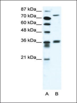 Anti-MID1 antibody produced in rabbit IgG fraction of antiserum