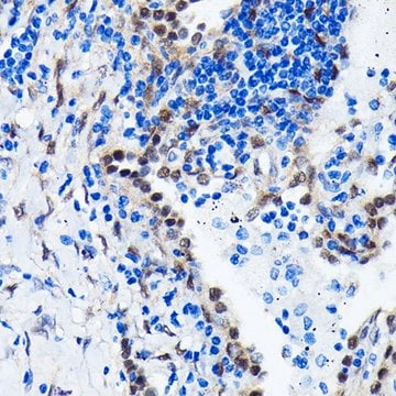 Anti-YAP1 antibody produced in rabbit