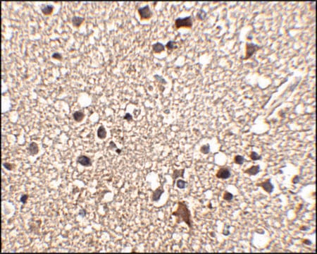 Anti-JPH3 antibody produced in rabbit affinity isolated antibody, buffered aqueous solution