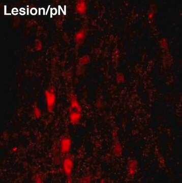 Anti-Nerve Growth Factor Antibody, pro serum, Chemicon&#174;