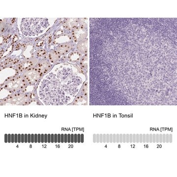 Monoclonal Anti-HNF1B antibody produced in mouse Prestige Antibodies&#174; Powered by Atlas Antibodies, clone CL0374, purified immunoglobulin, buffered aqueous glycerol solution