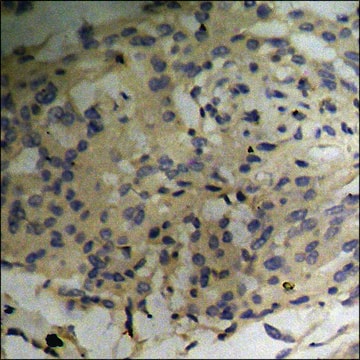 Anti-phospho-p70 S6 Kinase (pThr229) antibody produced in rabbit affinity isolated antibody