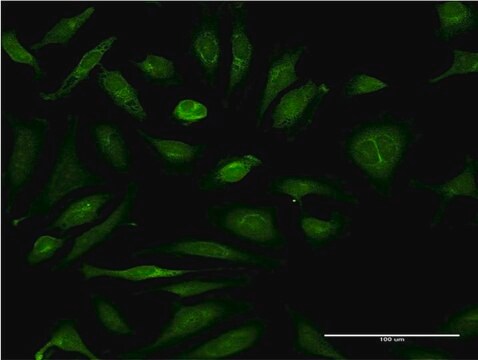 Monoclonal Anti-CSAD antibody produced in mouse clone 2C11, purified immunoglobulin, buffered aqueous solution