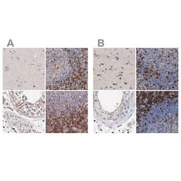 Anti-GIMAP4 antibody produced in rabbit Prestige Antibodies&#174; Powered by Atlas Antibodies, affinity isolated antibody, buffered aqueous glycerol solution