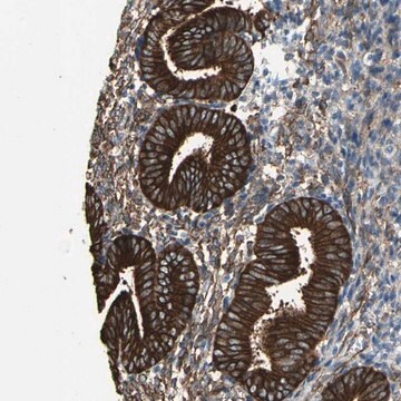 Anti-EPB41L2 antibody produced in rabbit Prestige Antibodies&#174; Powered by Atlas Antibodies, affinity isolated antibody, buffered aqueous glycerol solution