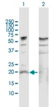 Anti-IL19 antibody produced in rabbit purified immunoglobulin, buffered aqueous solution