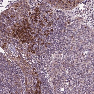 Anti-WDR83OS antibody produced in rabbit Prestige Antibodies&#174; Powered by Atlas Antibodies, affinity isolated antibody