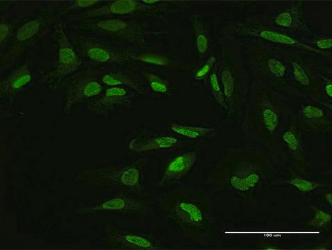 Anti-YY1 antibody produced in mouse purified immunoglobulin, buffered aqueous solution