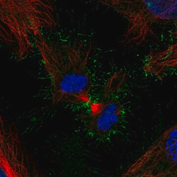 Anti-PSCA antibody produced in rabbit Prestige Antibodies&#174; Powered by Atlas Antibodies, affinity isolated antibody