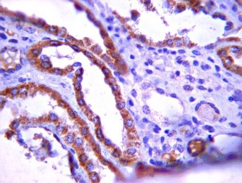 Anti-PTCH1-Antikörper (Protein Patched Homolog 1) from rabbit, purified by affinity chromatography