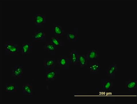 Anti-ZNF593 antibody produced in mouse IgG fraction of antiserum, buffered aqueous solution