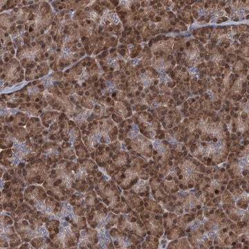 Anti-RNF125 antibody produced in rabbit Prestige Antibodies&#174; Powered by Atlas Antibodies, affinity isolated antibody, buffered aqueous glycerol solution