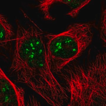 Anti-DKC1 antibody produced in rabbit Prestige Antibodies&#174; Powered by Atlas Antibodies, affinity isolated antibody