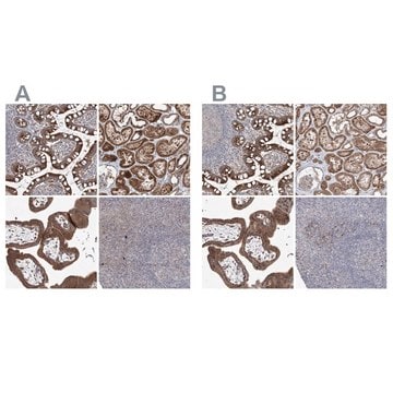 Anti-KLC4 antibody produced in rabbit Prestige Antibodies&#174; Powered by Atlas Antibodies, affinity isolated antibody, buffered aqueous glycerol solution, ab2