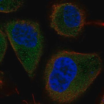 Anti-Tbc1D13 Antibody Produced In Rabbit Prestige Antibodies&#174; Powered by Atlas Antibodies, affinity isolated antibody, buffered aqueous glycerol solution