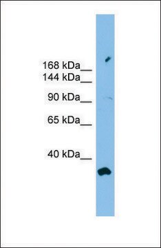 Anti-PACS2 antibody produced in rabbit affinity isolated antibody