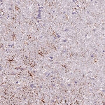 Anti-SLC35E3 antibody produced in rabbit Prestige Antibodies&#174; Powered by Atlas Antibodies, affinity isolated antibody, buffered aqueous glycerol solution