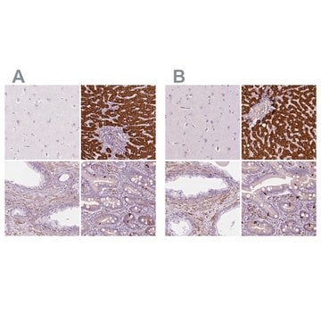 抗CES1 ウサギ宿主抗体 Prestige Antibodies&#174; Powered by Atlas Antibodies, affinity isolated antibody, buffered aqueous glycerol solution