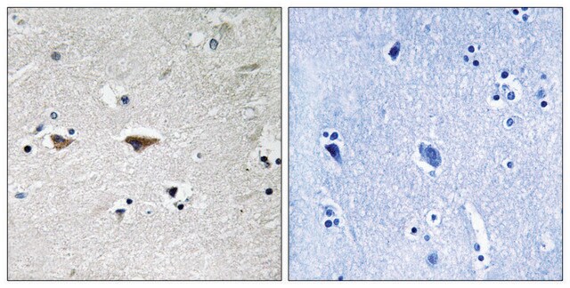 Anti-SRC, N-Terminal antibody produced in rabbit affinity isolated antibody