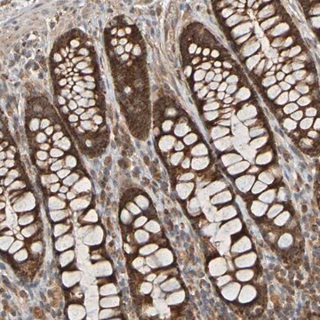 Anti-TMBIM1 antibody produced in rabbit Prestige Antibodies&#174; Powered by Atlas Antibodies, affinity isolated antibody, buffered aqueous glycerol solution