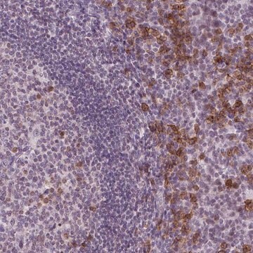 Anti-TMEM184A antibody produced in rabbit Prestige Antibodies&#174; Powered by Atlas Antibodies, affinity isolated antibody, buffered aqueous glycerol solution