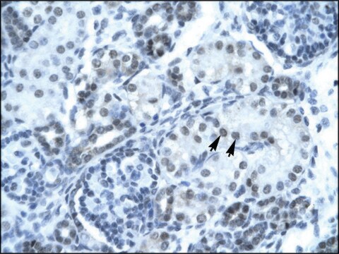 Anti-PAX2 IgG fraction of antiserum