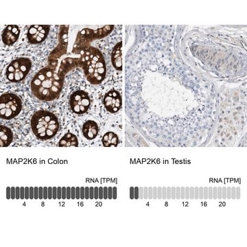 Anti-MAP2K6 antibody produced in rabbit Prestige Antibodies&#174; Powered by Atlas Antibodies, affinity isolated antibody, buffered aqueous glycerol solution