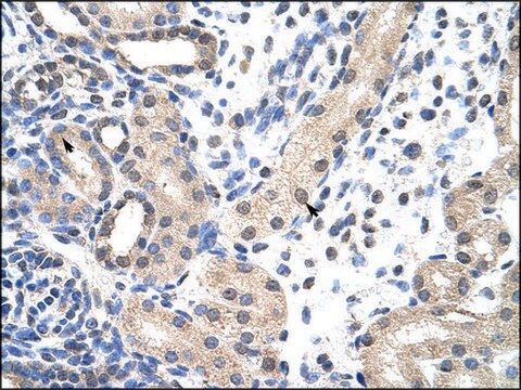 Anti-SNRPD1 antibody produced in rabbit affinity isolated antibody