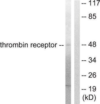 Anti-Thrombin Receptor, N-Terminal antibody produced in rabbit affinity isolated antibody