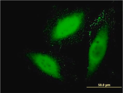 Monoclonal Anti-SGK2 antibody produced in mouse clone 3D2, purified immunoglobulin, buffered aqueous solution