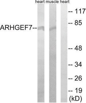 Anti-ARHGEF7 antibody produced in rabbit affinity isolated antibody