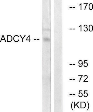 Anti-ADCY4 antibody produced in rabbit affinity isolated antibody