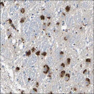 Anti-DGAT2 antibody produced in rabbit Prestige Antibodies&#174; Powered by Atlas Antibodies, affinity isolated antibody, buffered aqueous glycerol solution