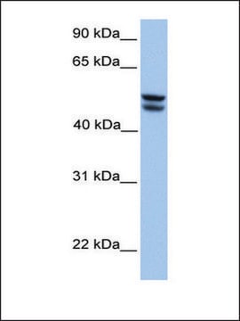 Anti-OXCT1 (AB2) antibody produced in rabbit affinity isolated antibody