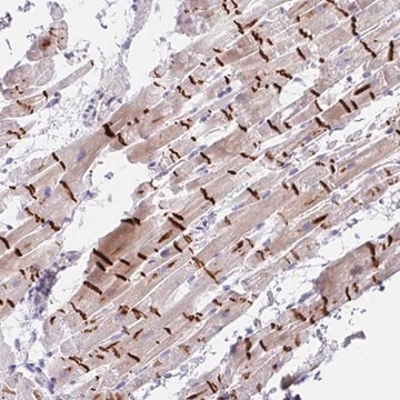 Anti-TMEM86A antibody produced in rabbit Prestige Antibodies&#174; Powered by Atlas Antibodies, affinity isolated antibody, buffered aqueous glycerol solution