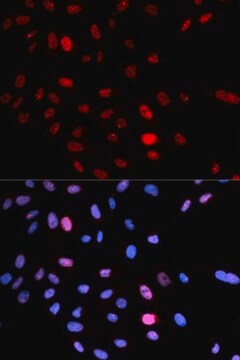 Anti-Phospho-SMC1A-S957 antibody produced in rabbit