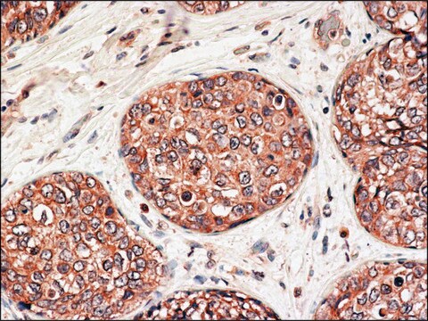 Anti-ApoD (C-terminal) antibody produced in rabbit ~1.0&#160;mg/mL, affinity isolated antibody