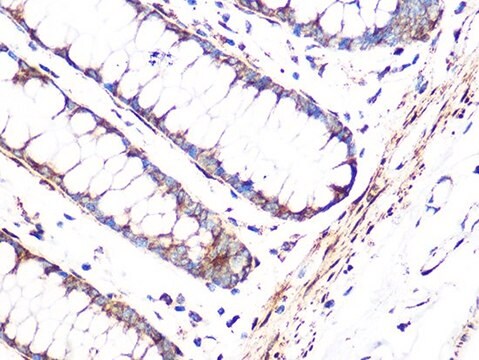 Anti-FHL1 antibody produced in rabbit